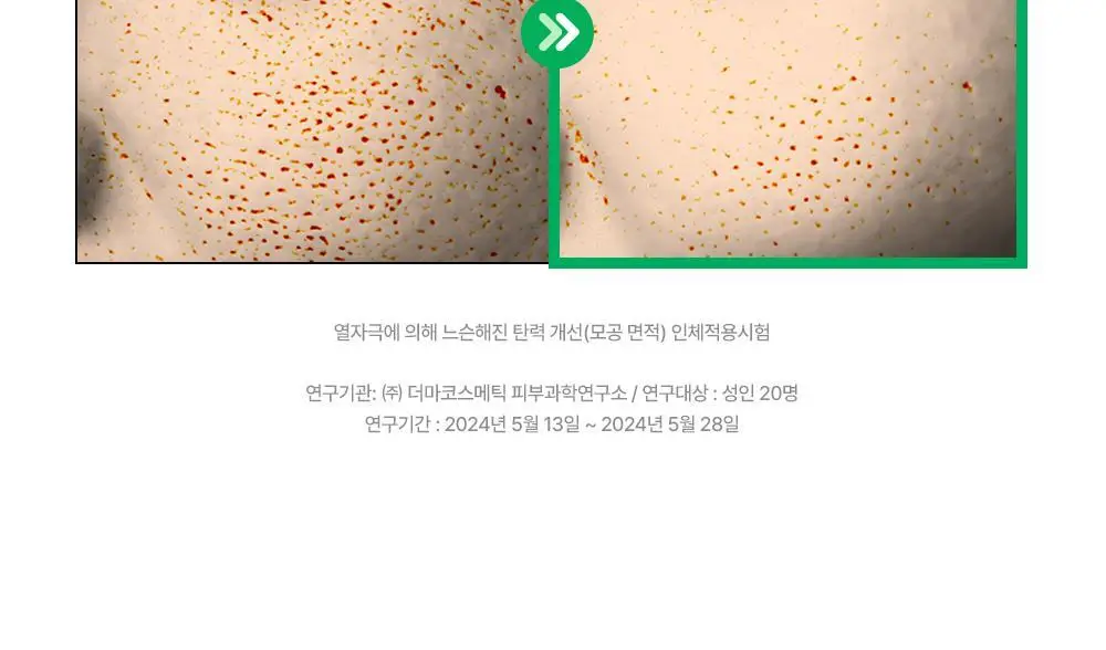[밀착진정] 듀이트리 AC 딥 진정 마스크 1매 (열감/흔적) 상세페이지 34